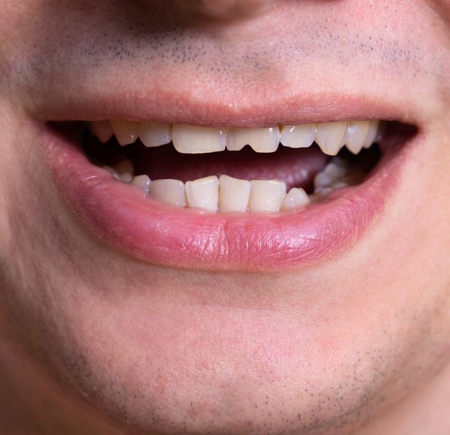 Treatments - Arte Dental
