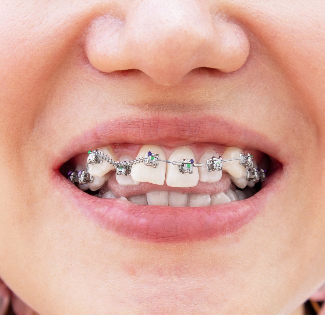 Treatments - Arte Dental
