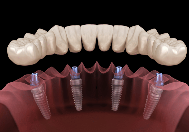 Arte Dental