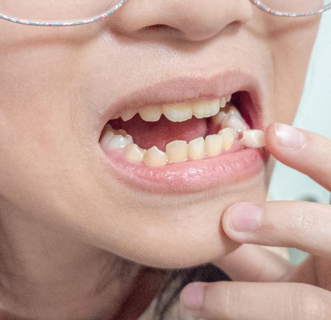 Treatments - Arte Dental