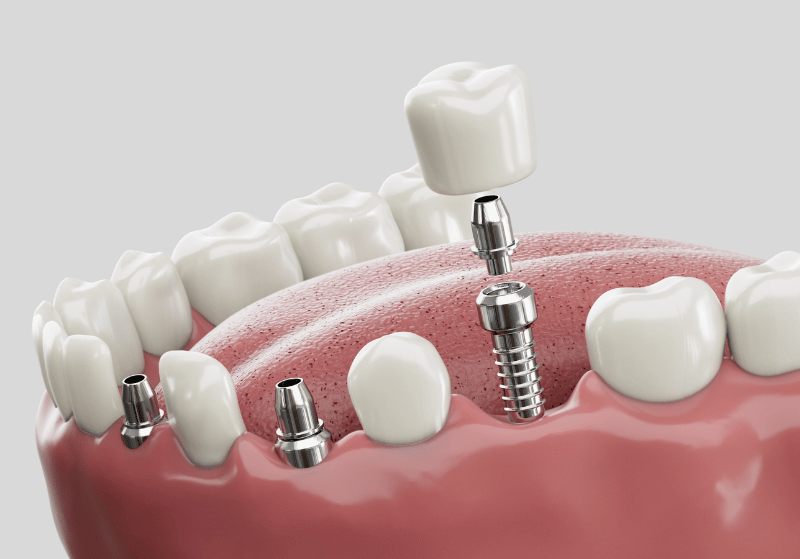 Arte Dental