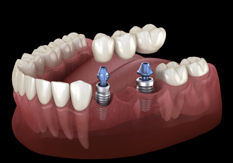 Arte Dental