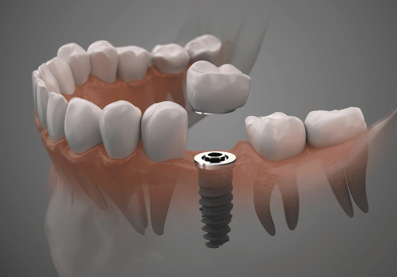Arte Dental
