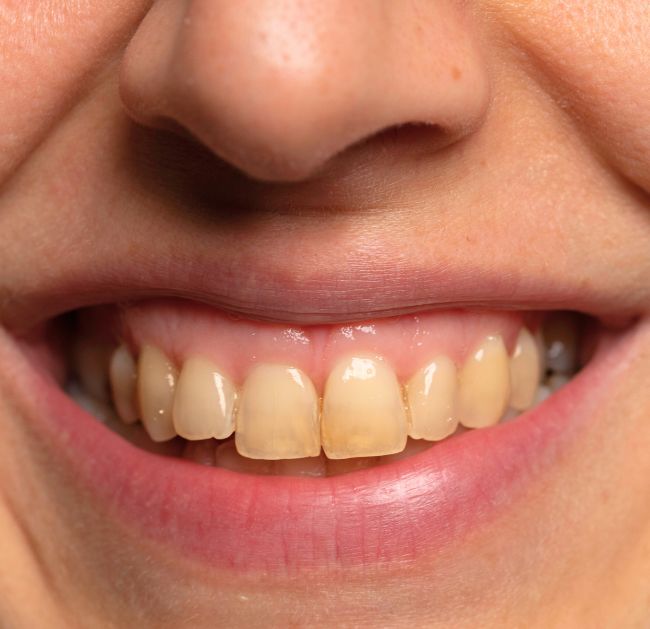 Treatments - Arte Dental