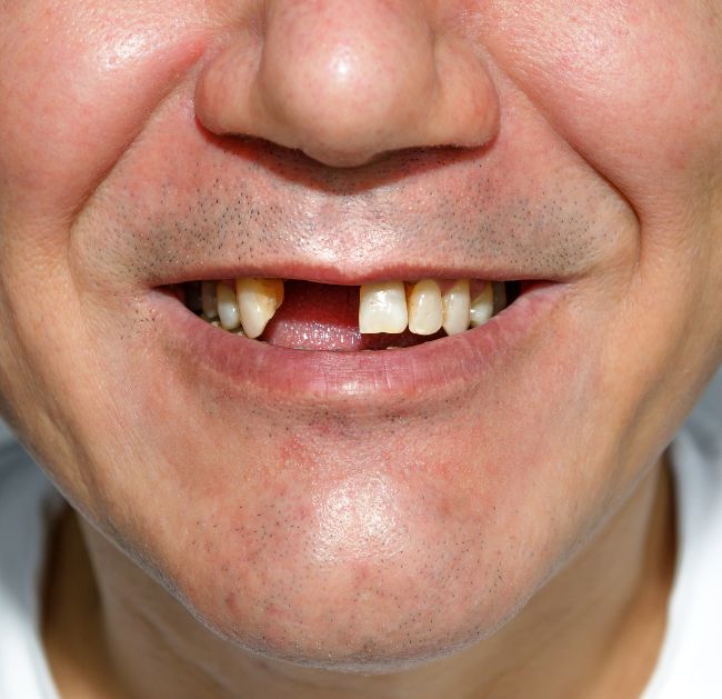 Treatments - Arte Dental