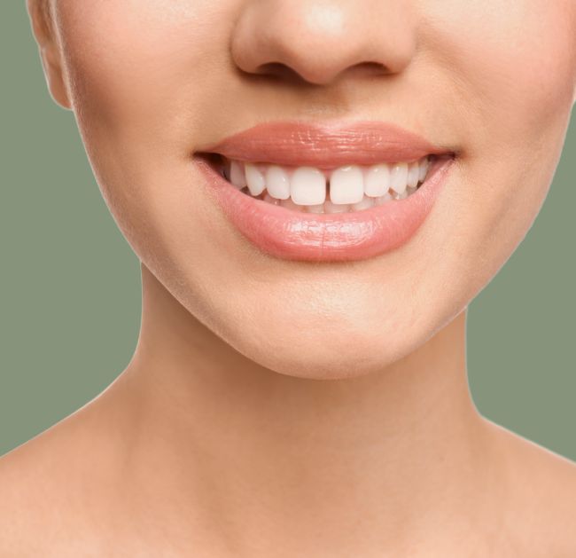 Treatments - Arte Dental