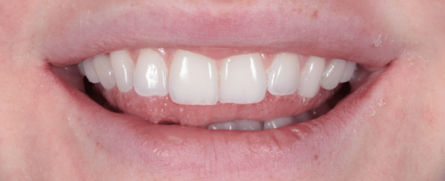 Before - Arte Dental