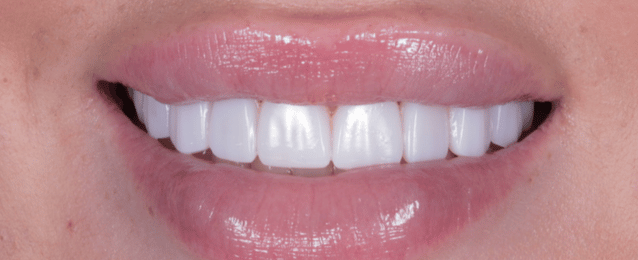 After - Arte Dental