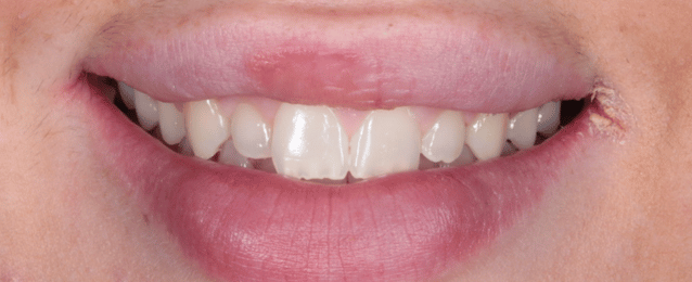 Before - Arte Dental