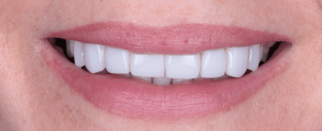 After - Arte Dental