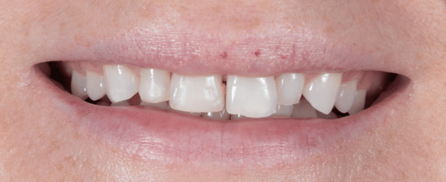 Before - Arte Dental