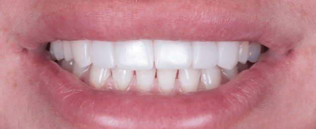 After - Arte Dental