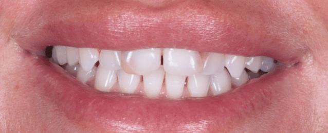 Before - Arte Dental