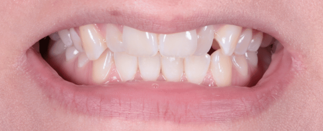 Before - Arte Dental