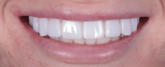 After - Arte Dental