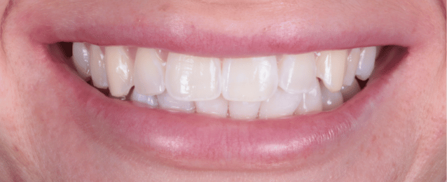 Before - Arte Dental