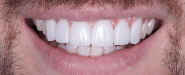 After - Arte Dental