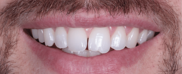 Before - Arte Dental