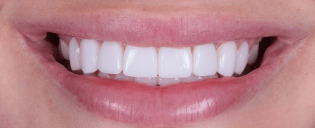 After - Arte Dental