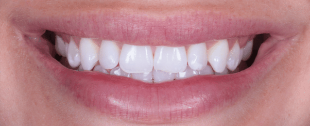 Before - Arte Dental