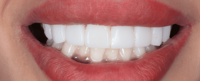 After - Arte Dental