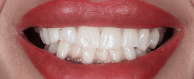 Before - Arte Dental