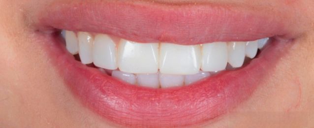After - Arte Dental
