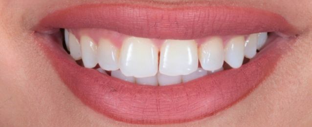 Before - Arte Dental