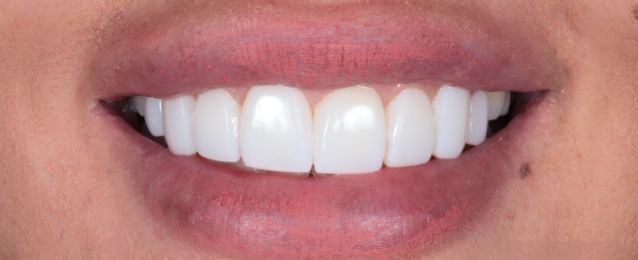 After - Arte Dental
