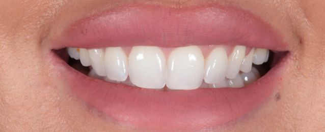 Before - Arte Dental