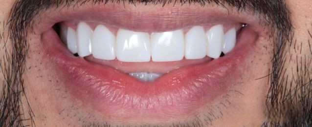 After - Arte Dental