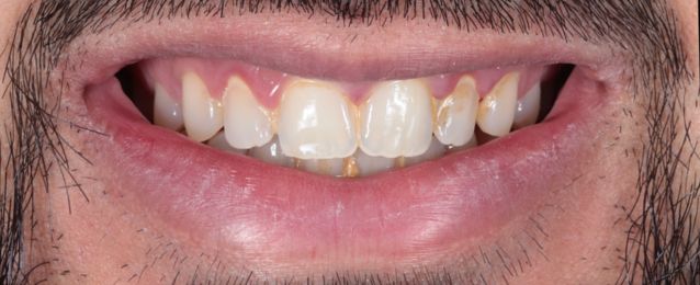 Before - Arte Dental