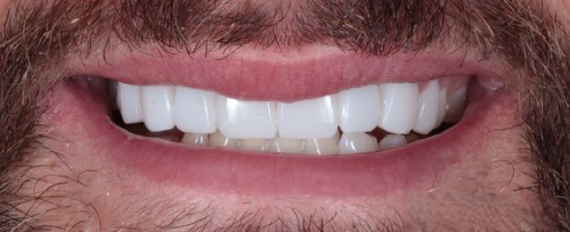 After - Arte Dental