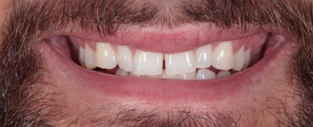Before - Arte Dental