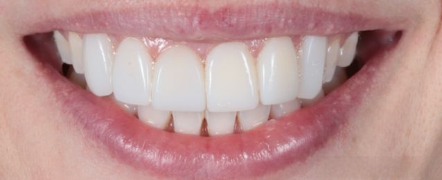 After - Arte Dental