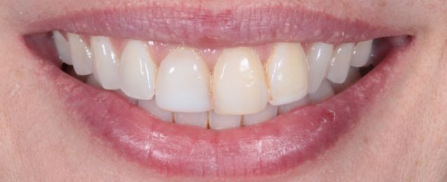 Before - Arte Dental