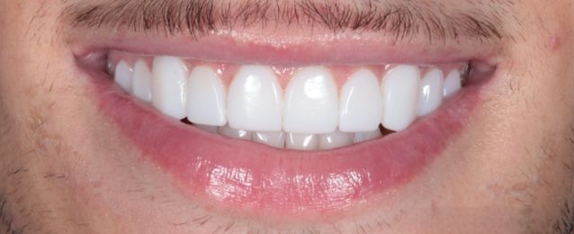 After - Arte Dental