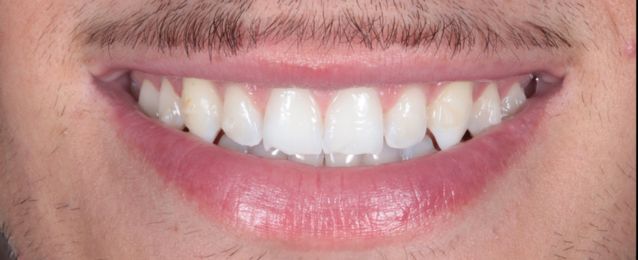 Before - Arte Dental