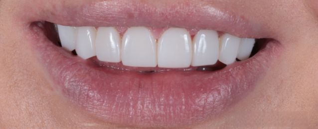 After - Arte Dental