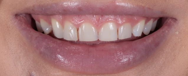 Before - Arte Dental