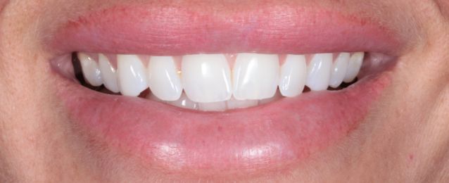 Before - Arte Dental