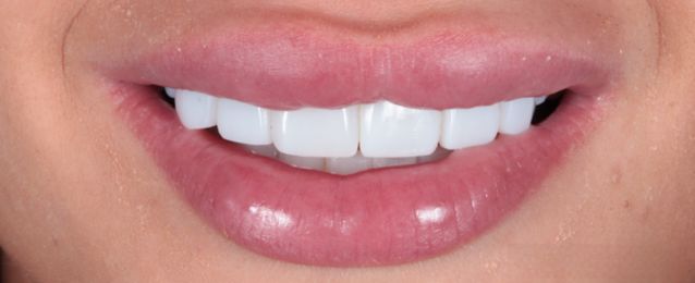 After - Arte Dental
