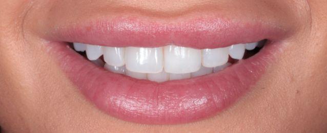 Before - Arte Dental