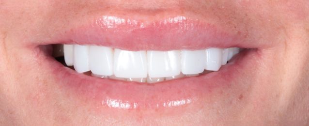 After - Arte Dental