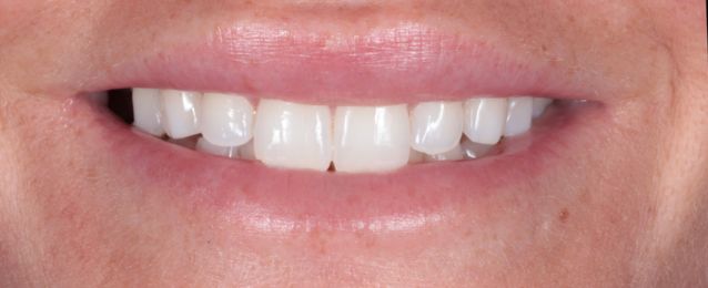 Before - Arte Dental