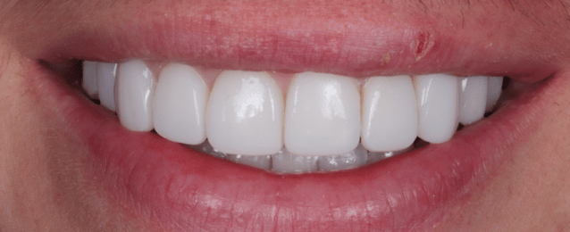 After -Arte Dental
