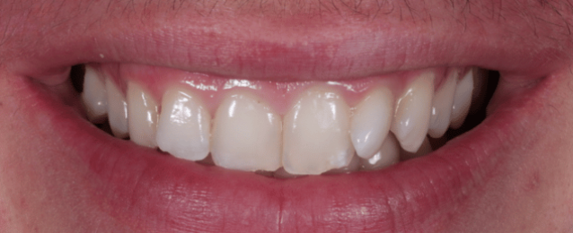 Before -Arte Dental