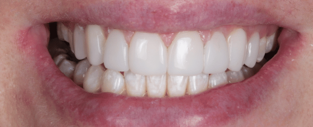 After -Arte Dental