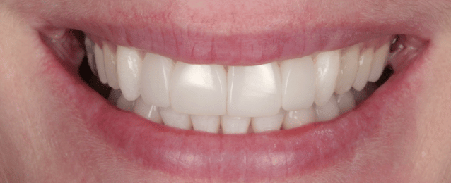 After -Arte Dental