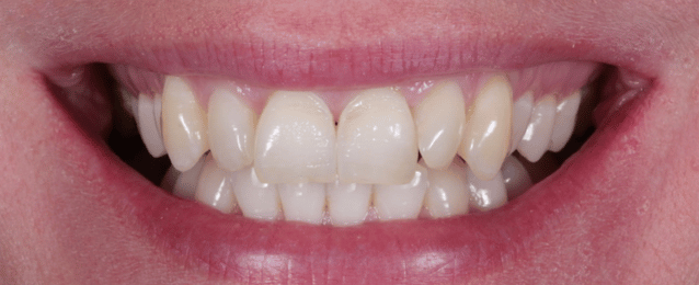 Before -Arte Dental